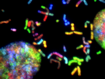 Microscopic image of brain cancer chromosomes