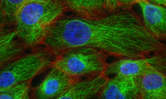 Stress fibers and microtubules in human breast cancer cells